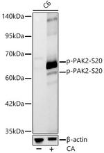 Phospho-PAK2 (Ser20) Antibody in Western Blot (WB)