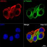 ABCA1 Antibody in Immunocytochemistry (ICC/IF)