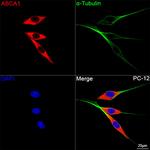 ABCA1 Antibody in Immunocytochemistry (ICC/IF)