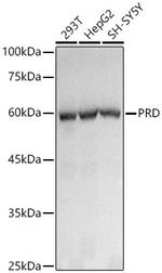 PEPD Antibody in Western Blot (WB)