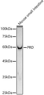 PEPD Antibody in Western Blot (WB)