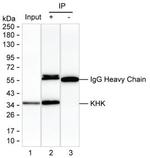 KHK Antibody in Immunoprecipitation (IP)