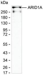 ARID1A Antibody in Western Blot (WB)