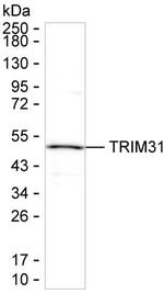 TRIM31 Antibody in Western Blot (WB)