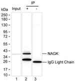 NAGK Antibody in Immunoprecipitation (IP)