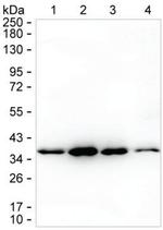 NAGK Antibody in Western Blot (WB)