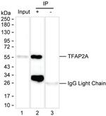 AP2 alpha Antibody in Immunoprecipitation (IP)