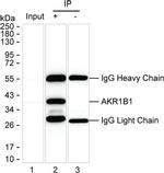 AKR1B1 Antibody in Immunoprecipitation (IP)