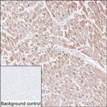 CaMKII delta Antibody in Immunohistochemistry (Paraffin) (IHC (P))