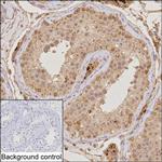 TRIM17 Antibody in Immunohistochemistry (Paraffin) (IHC (P))