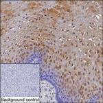 SULT2B1 Antibody in Immunohistochemistry (Paraffin) (IHC (P))