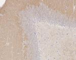 NMDAR2B Antibody in Immunohistochemistry (Paraffin) (IHC (P))