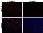 NMDAR2B Antibody