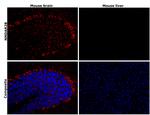 NMDAR2B Antibody