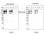 NMDAR2B Antibody in Western Blot (WB)