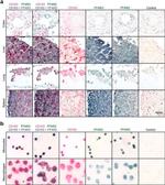 CD163 Antibody in Immunohistochemistry (Paraffin) (IHC (P))