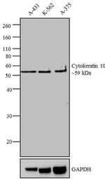Cytokeratin 10 Antibody in Western Blot (WB)