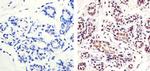 Ki-67 Antibody in Immunohistochemistry (Paraffin) (IHC (P))