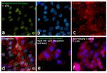 Progesterone Receptor Antibody