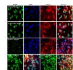 SUMO1 Antibody in Immunocytochemistry (ICC/IF)