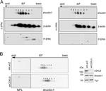 NEFL Antibody in Western Blot (WB)