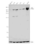 Acetyl-CoA Carboxylase Antibody in Western Blot (WB)