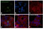 Phospho-p53 (Ser15) Antibody