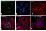 Phospho-p53 (Ser15) Antibody in Immunocytochemistry (ICC/IF)