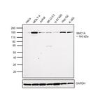 SMC1 Antibody in Western Blot (WB)