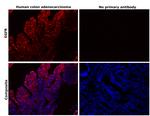 EGFR Antibody in Immunohistochemistry (Paraffin) (IHC (P))