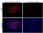 EGFR Antibody in Immunohistochemistry (Paraffin) (IHC (P))