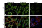 SKP1 Antibody in Immunocytochemistry (ICC/IF)