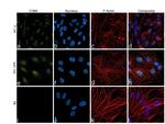 CYBA Antibody in Immunocytochemistry (ICC/IF)