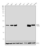 HSPB8 Antibody in Western Blot (WB)