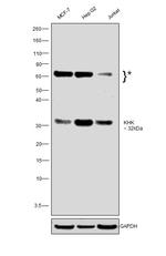 KHK Antibody in Western Blot (WB)