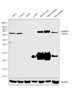 SAMHD1 Antibody in Western Blot (WB)