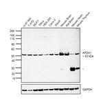 AP2M1 Antibody in Western Blot (WB)