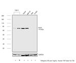 ALOX5 Antibody in Western Blot (WB)