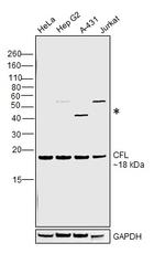 Cofilin Antibody in Western Blot (WB)