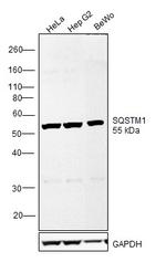 SQSTM1 Antibody in Western Blot (WB)