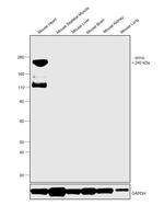 MYH6 Antibody in Western Blot (WB)