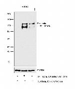 E-selectin Antibody in Western Blot (WB)