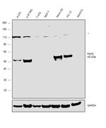 PAX3 Antibody in Western Blot (WB)