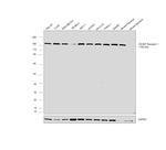 VEGF Receptor 1 Antibody in Western Blot (WB)