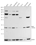 RAB5 Antibody in Western Blot (WB)