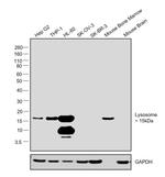 Lysozyme Antibody in Western Blot (WB)