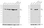 GRK2 Antibody in Western Blot (WB)