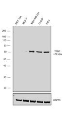 TPH1 Antibody