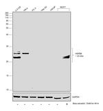 HSPB8 Antibody