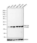 PP1 beta Antibody in Western Blot (WB)